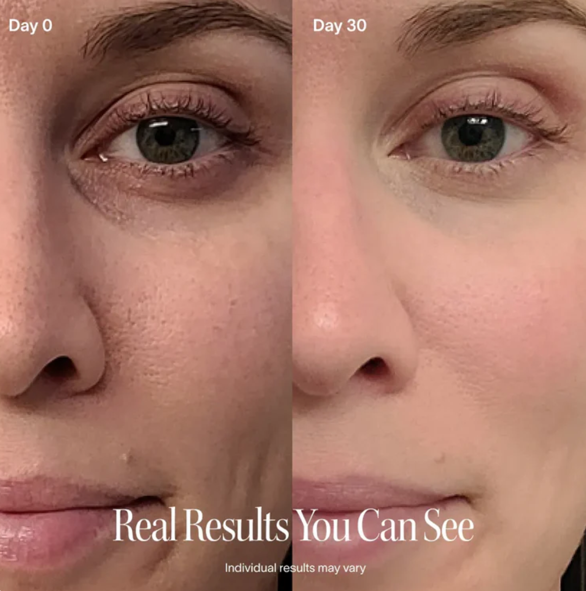 Kalore 4-in-1 Radiant Renewal Skincare Wand with Red Light Therapy