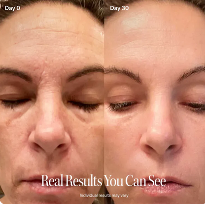 Kalore 4-in-1 Radiant Renewal Skincare Wand with Red Light Therapy